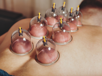 La Ventouse, Votre Alliée Contre la Douleur, le Stress et la Cellulite